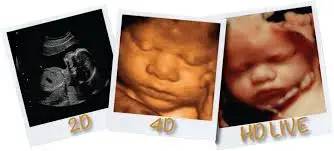 孕期做四维检查，了解这些指标，不用求医生，自己看胎儿是否健康